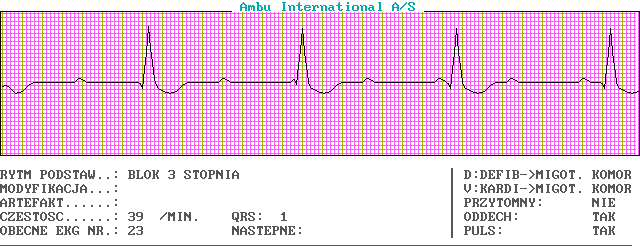 Wykresy EKG - c23-0.png