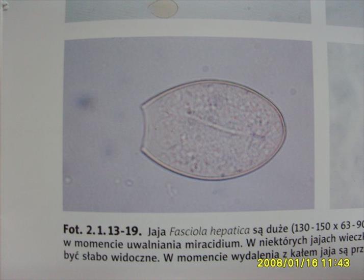 atlas parazytów - Fasciola hepatica - jaja.JPG
